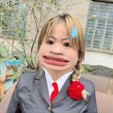 张大嘴